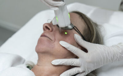 Huidverbetering met de Clarity II laser: pigment, vaatjes en beenvaten
