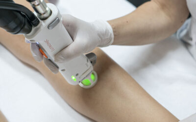 Laserontharing met de Clarity II laser